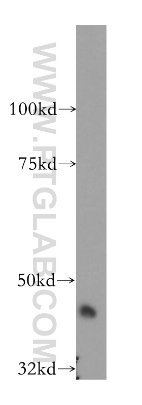 SERPINI2 Polyclonal antibody