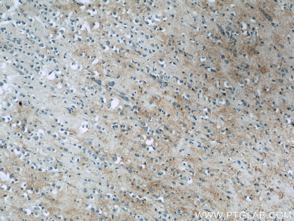 BNP Polyclonal antibody