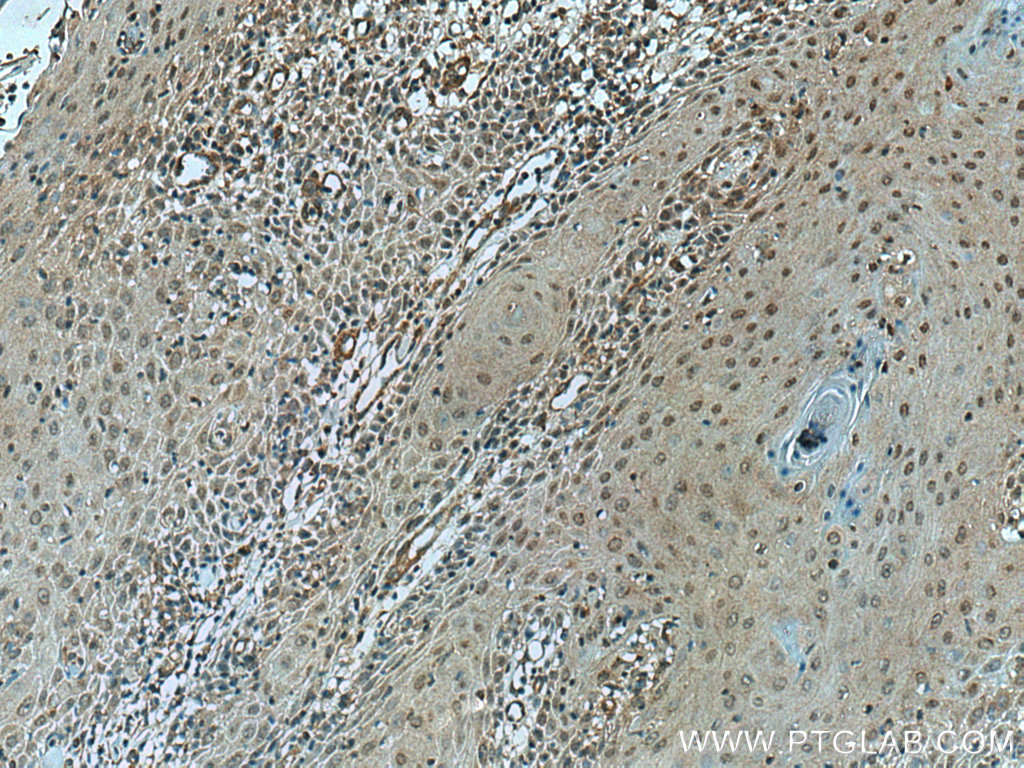 VASH2 Polyclonal antibody