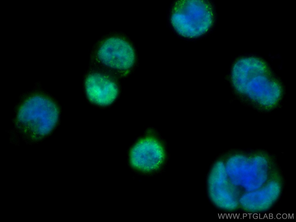 SH3RF2 Polyclonal antibody
