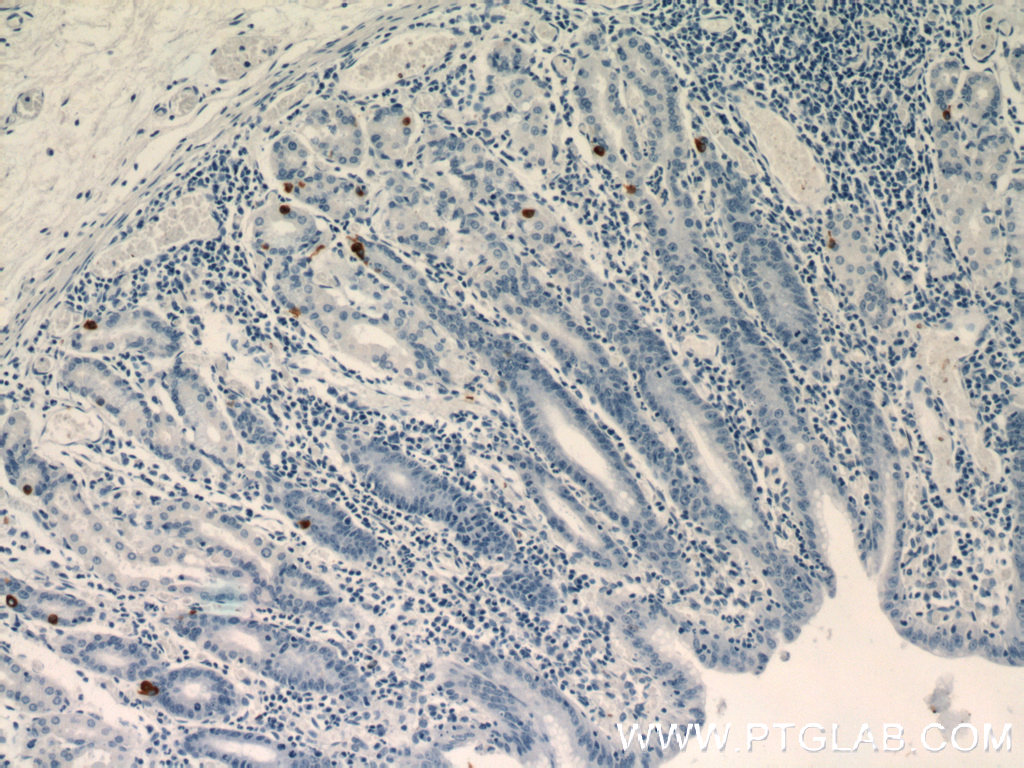 GHRL Polyclonal antibody