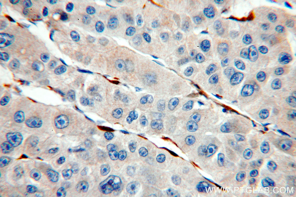 Cytoglobin Polyclonal antibody