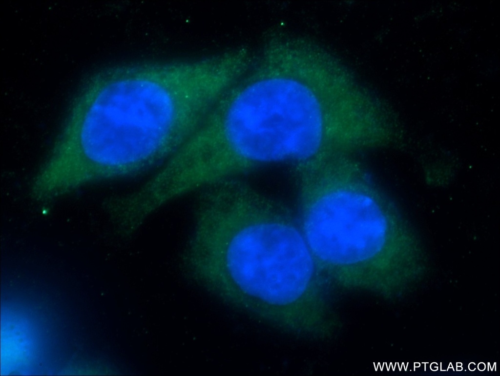 CSDE1 Polyclonal antibody