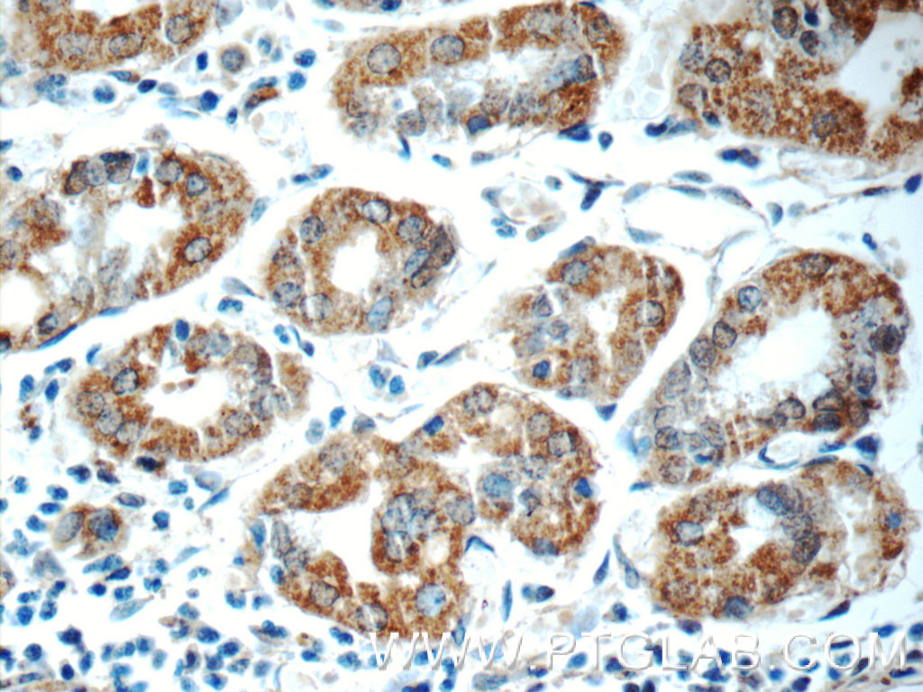ADA Polyclonal antibody