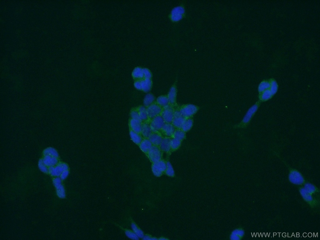 PPP3CB Polyclonal antibody