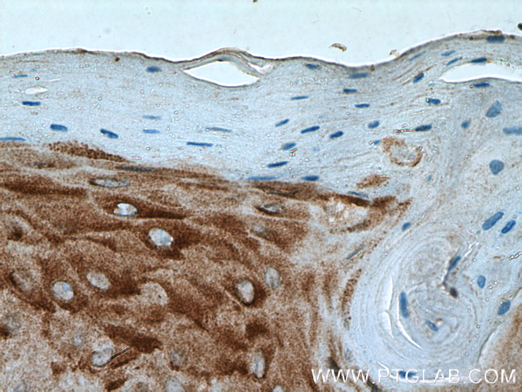 PLA2G4D Polyclonal antibody