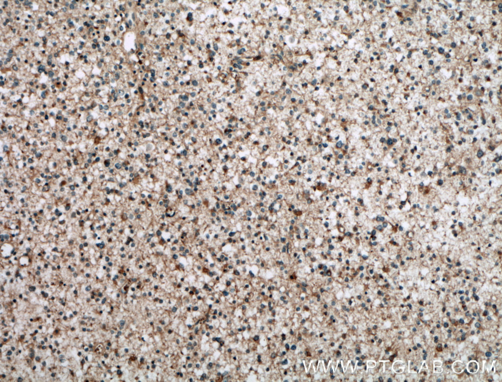 RAB39 Polyclonal antibody