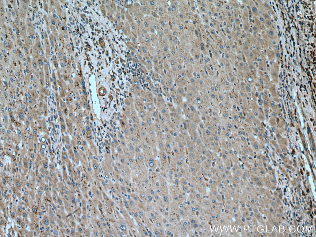 PIP5K3 Polyclonal antibody