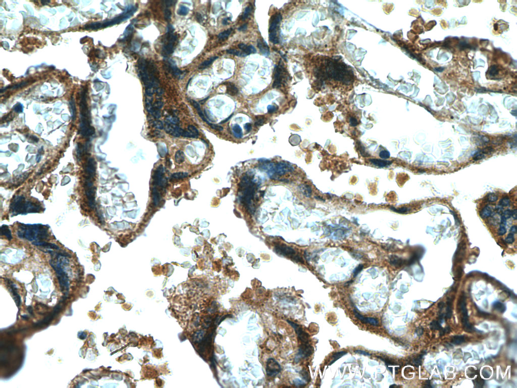 CYP11A1 Polyclonal antibody