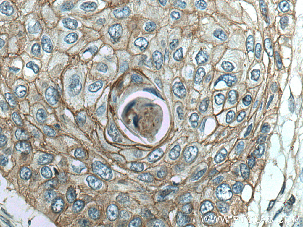 LYNX1 Polyclonal antibody