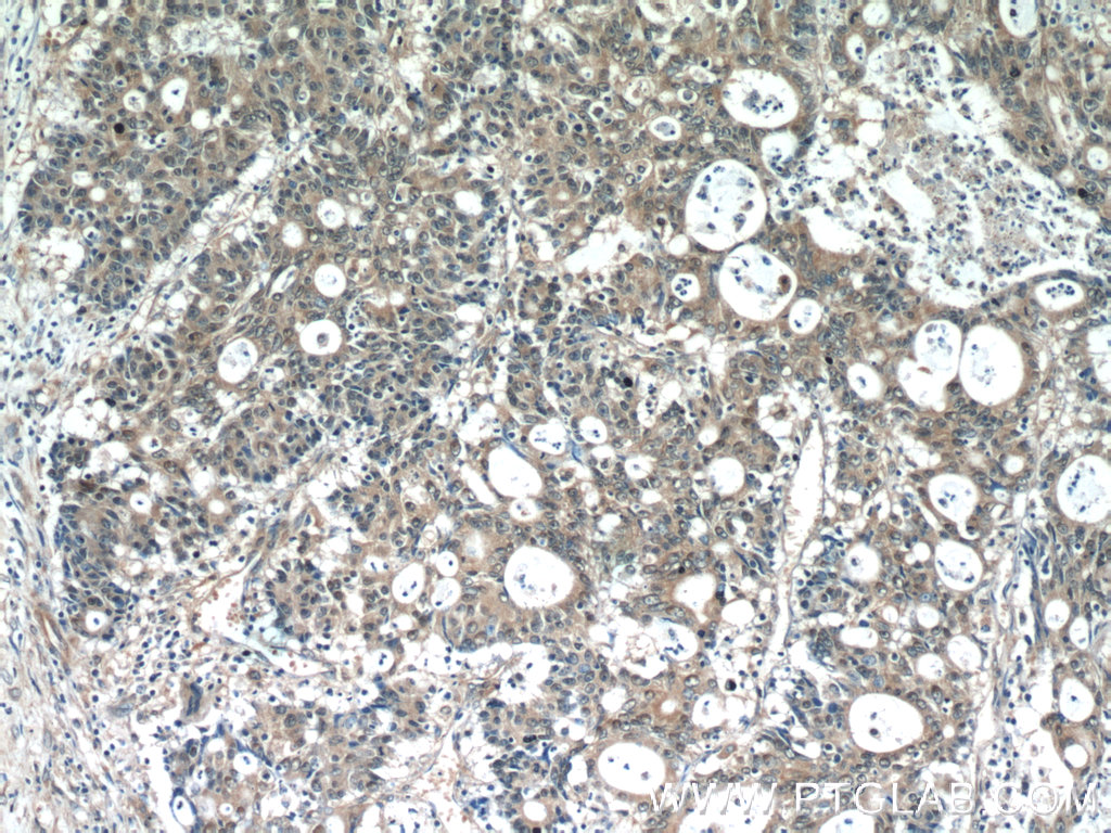 SCFD2 Polyclonal antibody
