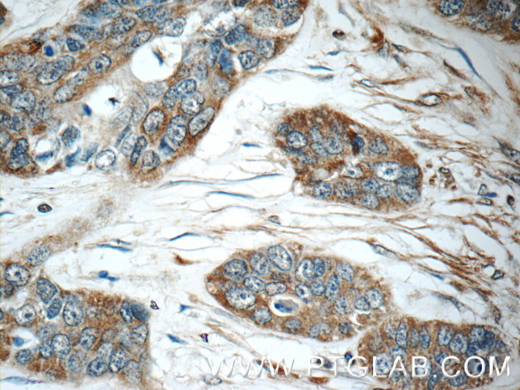 IFIT5 Polyclonal antibody