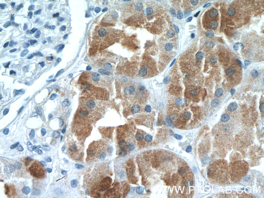 IHH Polyclonal antibody