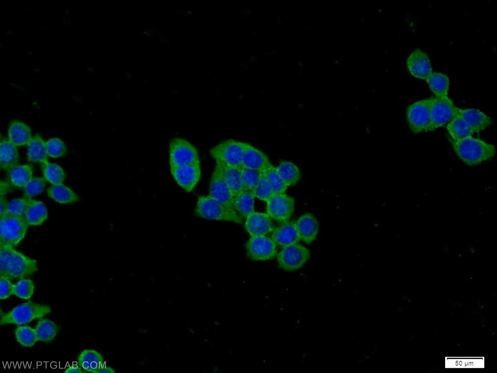 PFKP Polyclonal antibody