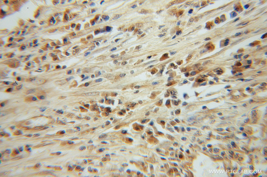 CLEC1A Polyclonal antibody
