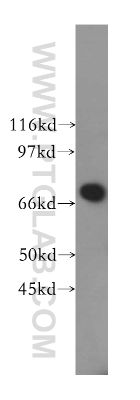 B4GALNT1 Polyclonal antibody