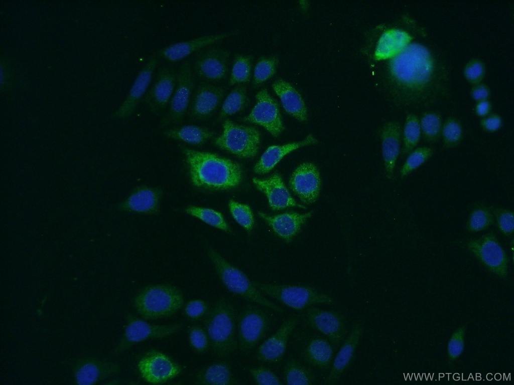 Zinc Alpha 2 Glycoprotein Polyclonal antibody