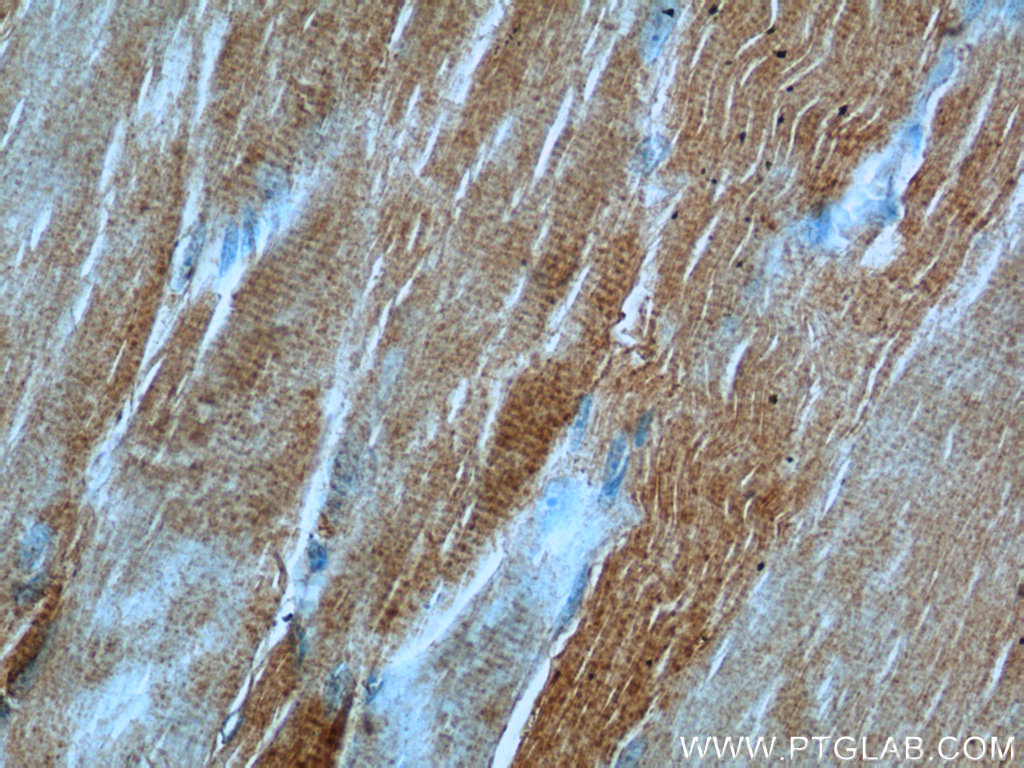 PHKB Polyclonal antibody
