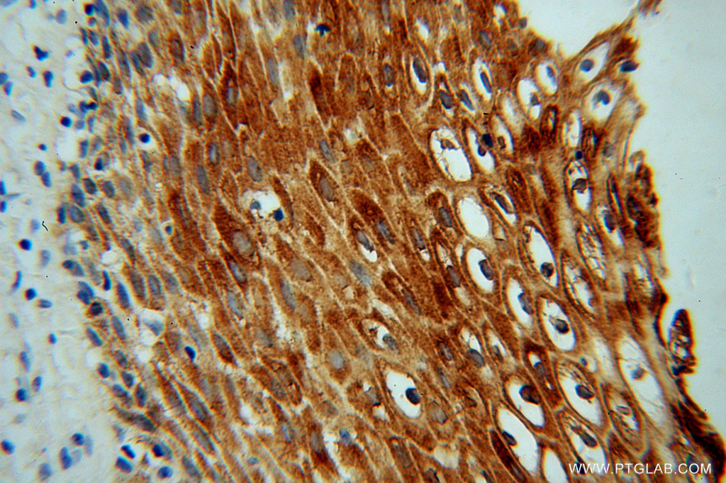 KIF22 Polyclonal antibody