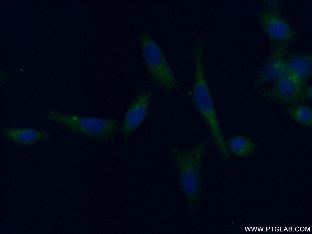 TRIM38 Polyclonal antibody