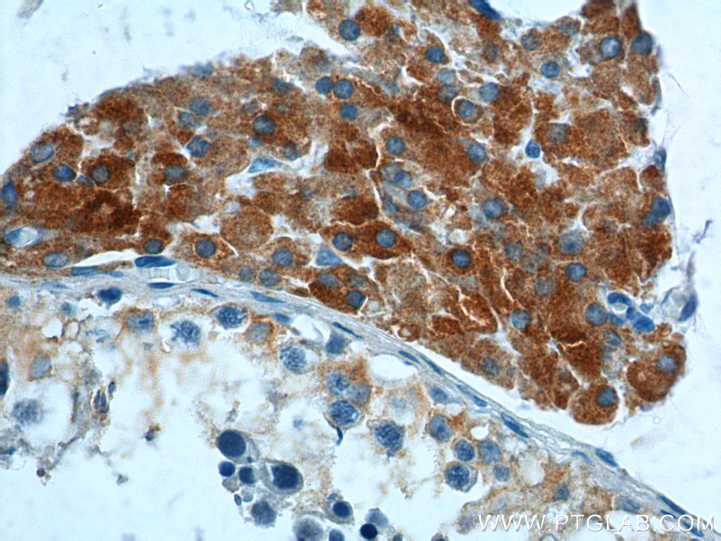 HSD17B3 Polyclonal antibody