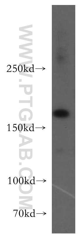 UGCGL2 Polyclonal antibody