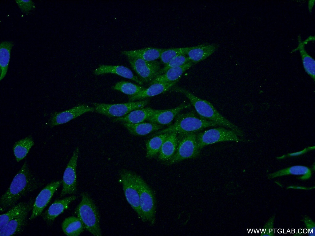 NDUFV3 Polyclonal antibody