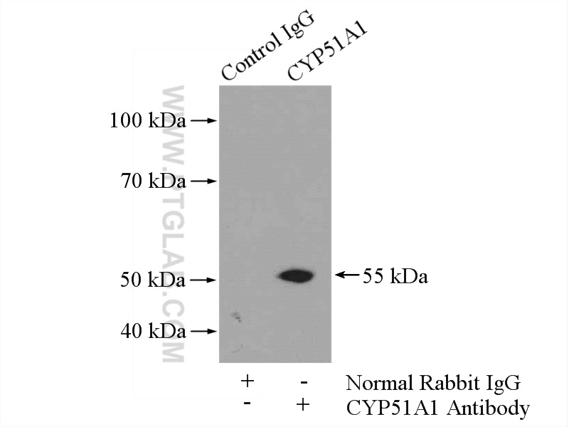 CYP51A1 Polyclonal antibody