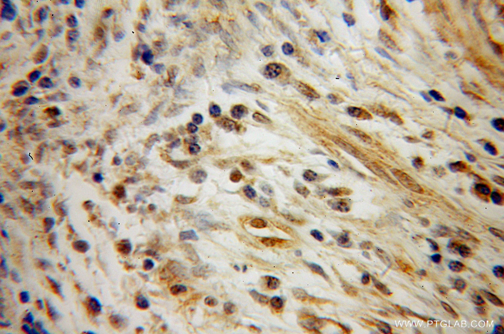 CSRP1 Polyclonal antibody