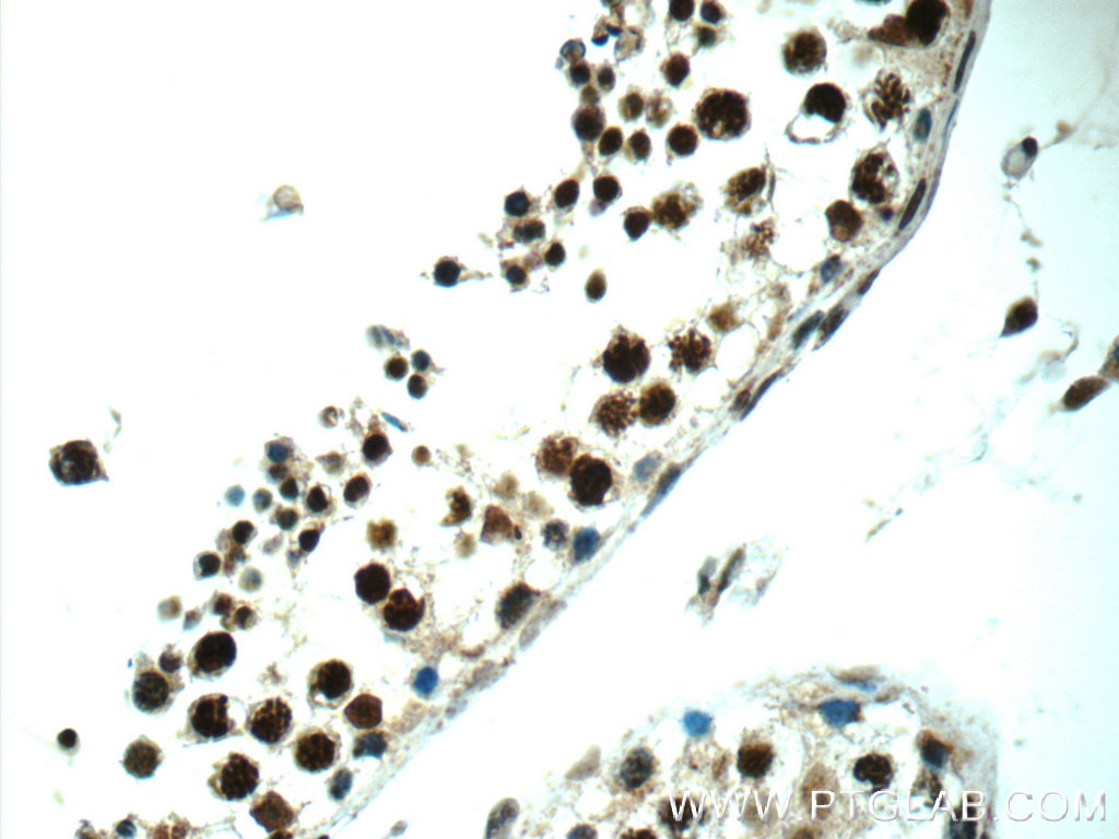 ALS2CR8 Polyclonal antibody