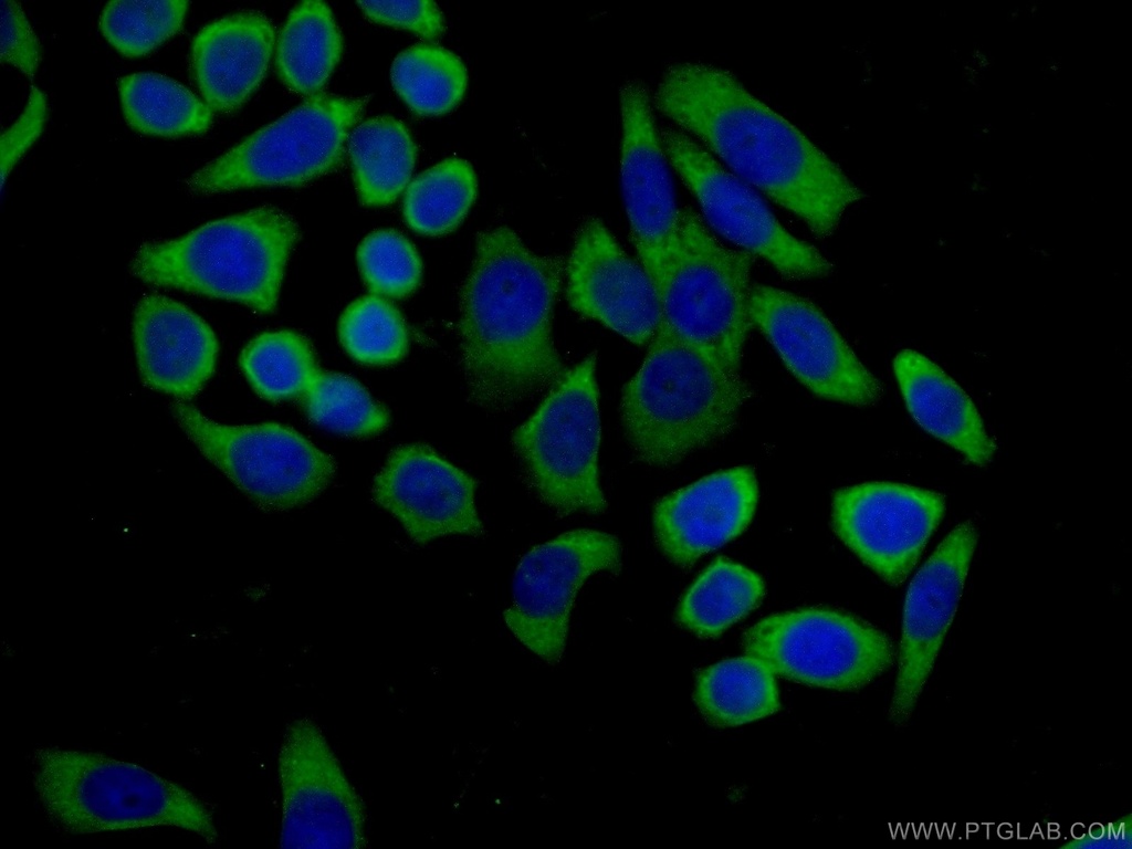 MTUS1 Polyclonal antibody