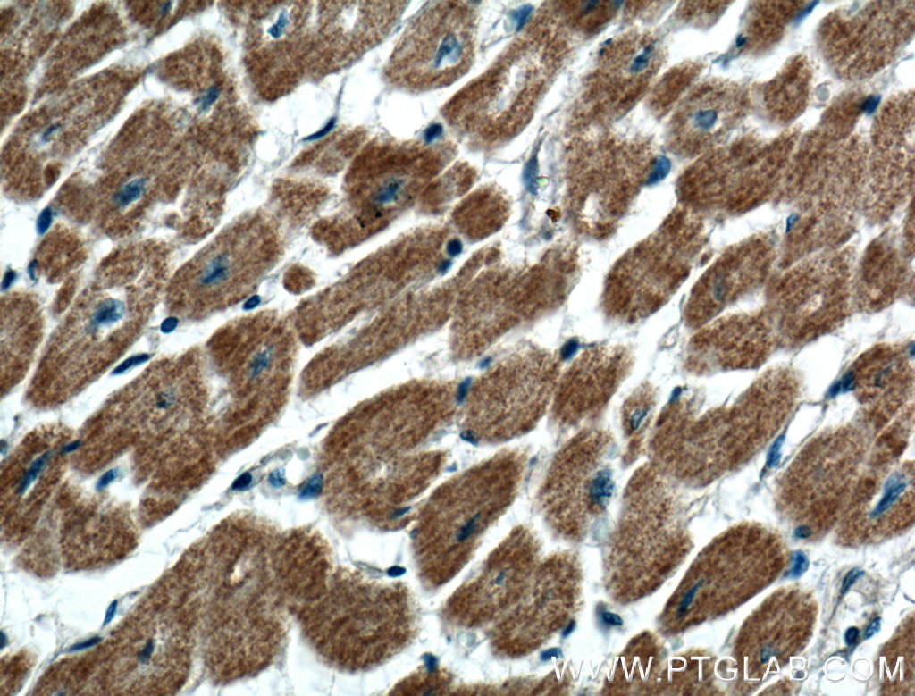 GIMAP2 Polyclonal antibody