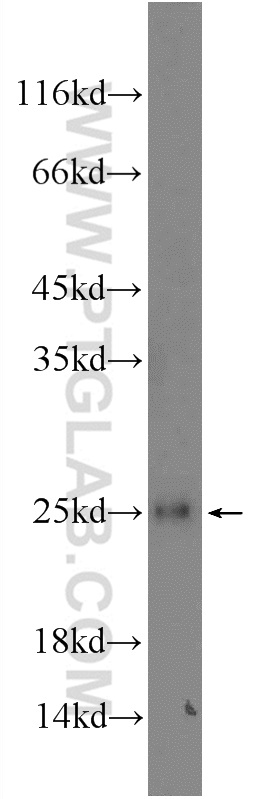 GCET2 Polyclonal antibody