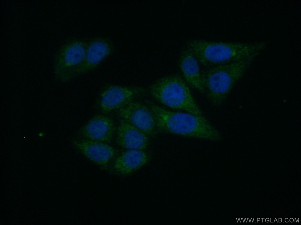GPD1 Polyclonal antibody