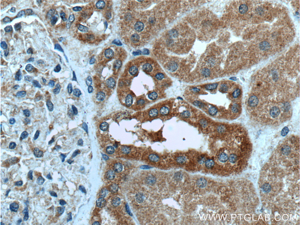 MAPK15 Polyclonal antibody