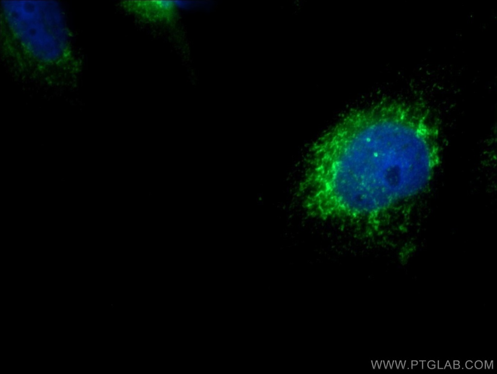 SDCCAG8 Polyclonal antibody