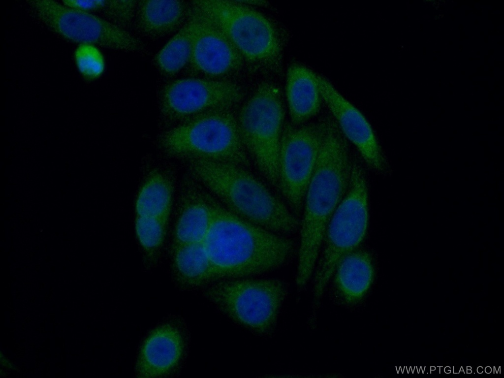 HRD1/SYVN1 Polyclonal antibody