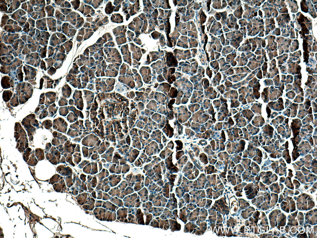 SPINK1 Polyclonal antibody