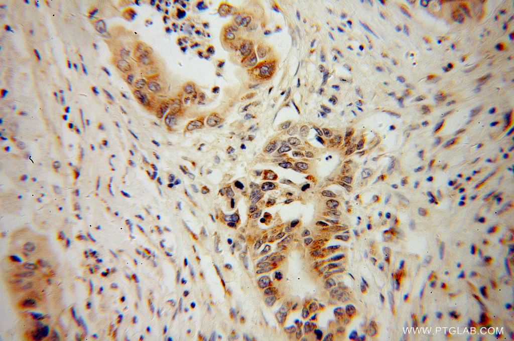 NGB Polyclonal antibody