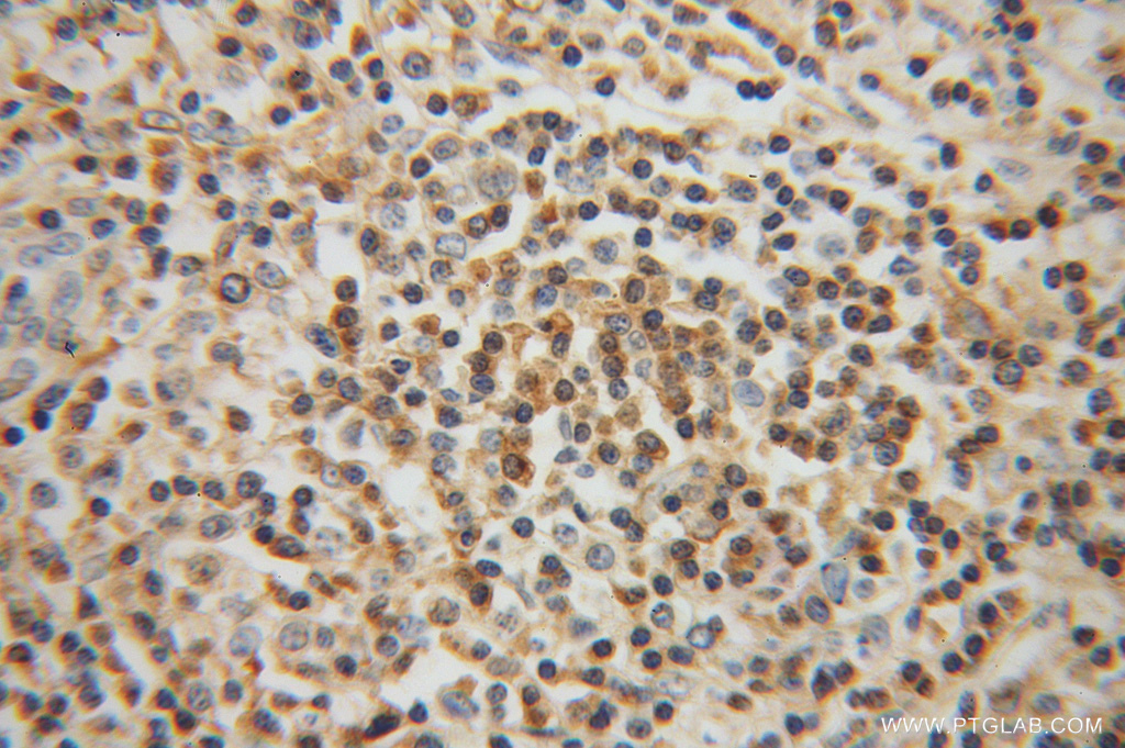 RIAM Polyclonal antibody