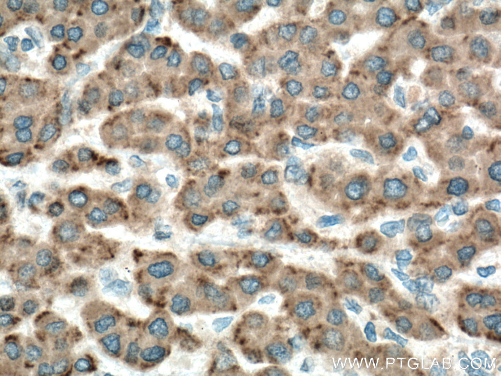 GPX7 Polyclonal antibody