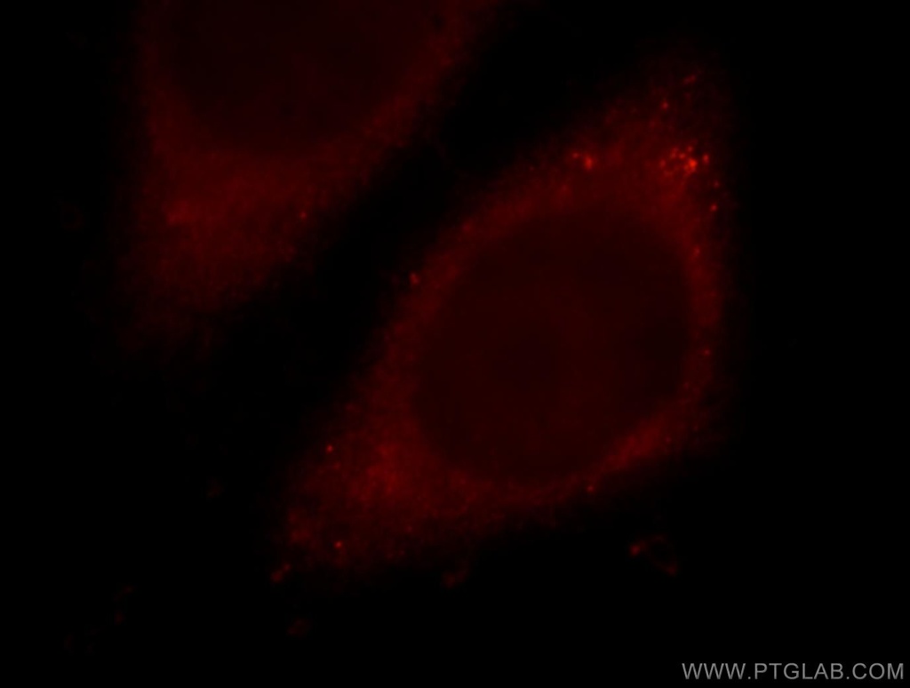 MTPN Polyclonal antibody
