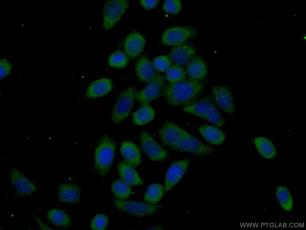 EEF2K Polyclonal antibody