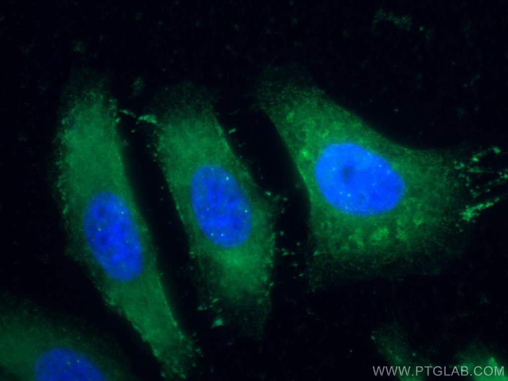 Choline Kinase Alpha Polyclonal antibody