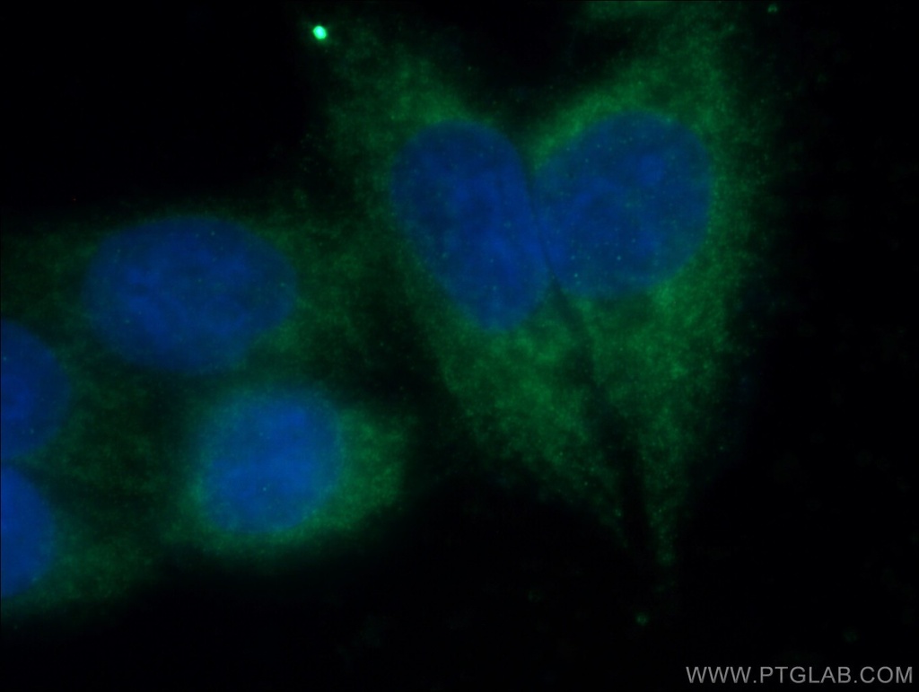 TDRKH specific Polyclonal antibody