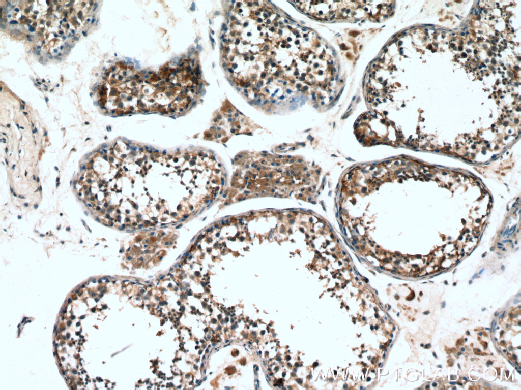 Proenkephalin-A Polyclonal antibody