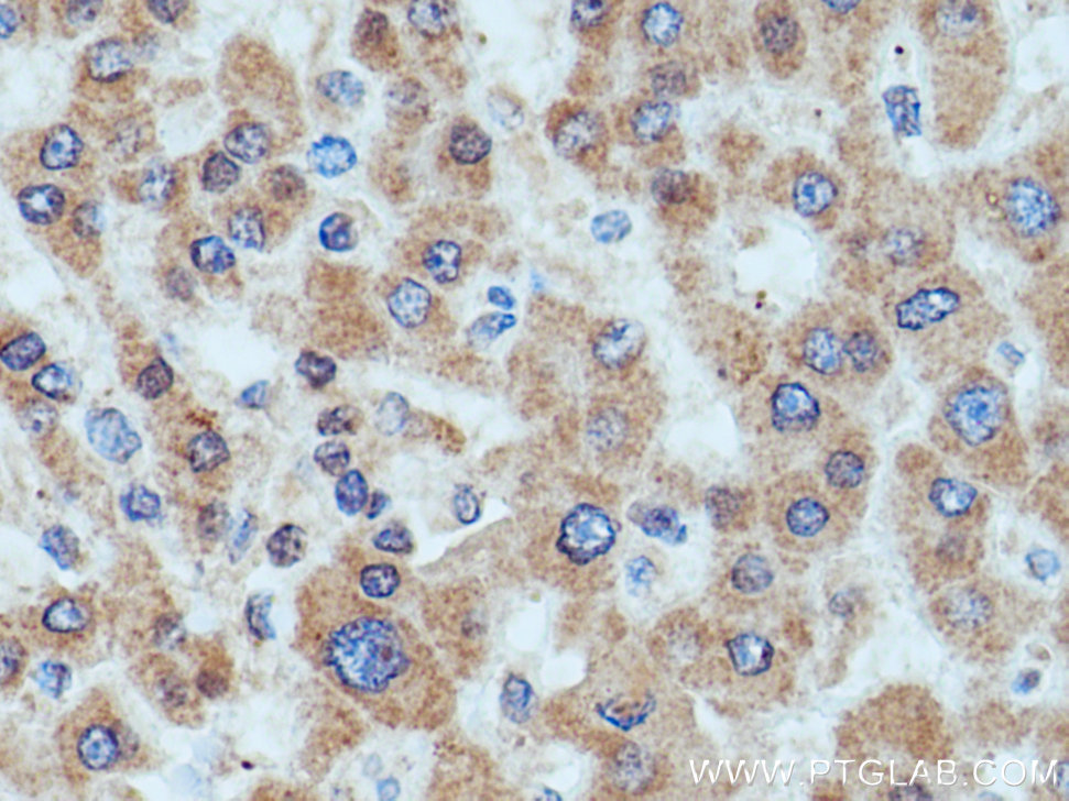 HMGCR Polyclonal antibody