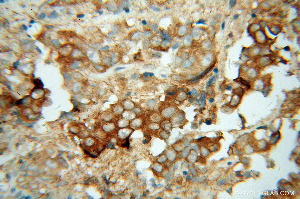 ACTL7B Polyclonal antibody