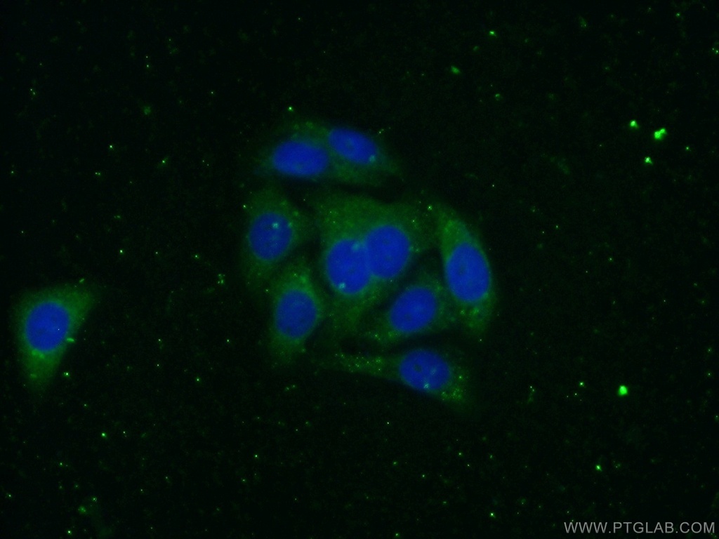 Alpha-2-Macroglobulin Polyclonal antibody