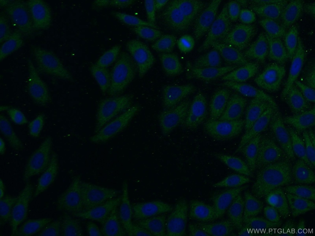 SFI1 Polyclonal antibody